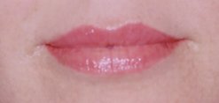 After permanent lip color, healed