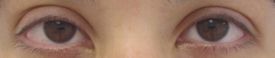 Eyeliner-before