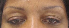 Brows Before