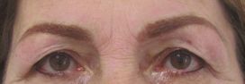 Brows-Eyeliner-After