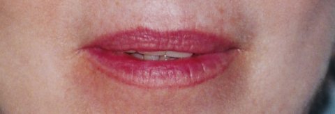client before permanent lip color correction