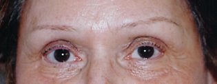 client before permanent eyebrows