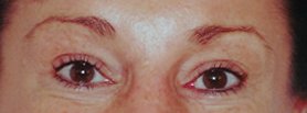 Before Permanent Eyebrows-Eyeliner