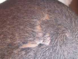 Scalp-before-procdedure